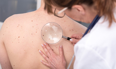 O que saber antes de ir ao dermatologista